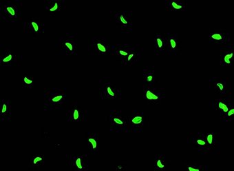 Antibodies against Toxoplasma gondii
